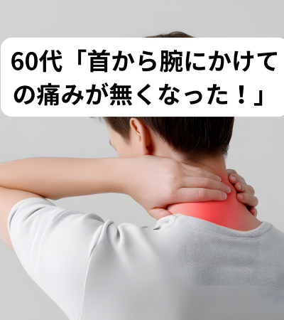 肩から腕にかけての痛みで来院された60代男性Cさん